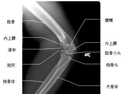 <font color="red">肘关节</font>侧位-X线片