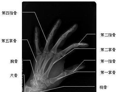 手<font color="red">斜</font>位