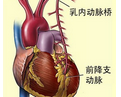 J Am Soc Echocardiogr：主动脉狭窄低血流量相关因素