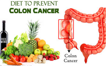 Lancet：宣传方式对结<font color="red">直肠</font>癌筛查的影响大有不同！