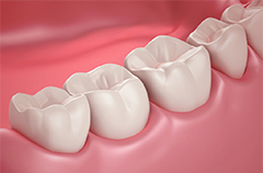 J Periodontol：重视<font color="red">牙</font>周健康！重度牙周炎可影响代谢综合征的发生