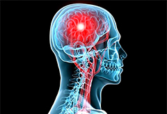 NEJM：低温联合标准治疗并不能更好的改善颅脑创伤患者的脑功能