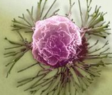 ESMO Asia 2015：帕布昔利布(palbociclib)+氟维司群治疗亚洲HR+/HER2-晚期乳腺癌女性疗效佳（PALOMA3试验亚洲结果）