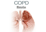 CHEST：COPD的加重与透明<font color="red">质</font>酸的炎性降解相关