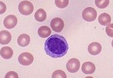 BMC <font color="red">Cancer</font>：中性粒细胞计与前列腺癌患者预后