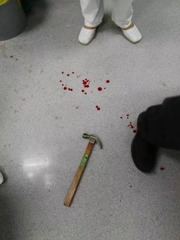 佛山一医院医生被女子用铁锤狠砸3锤 头破血流