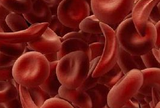 NEJM：抗淋巴细胞球蛋白可减少慢性移植物抗宿主病的发生