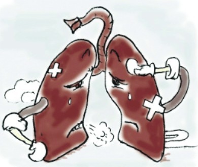 PNAS：肺部炎症微环境可促进癌症肺转移