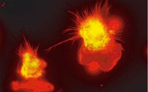 Science：巨噬细胞再认识，分化后依然像干细胞一样<font color="red">自我</font><font color="red">更新</font>