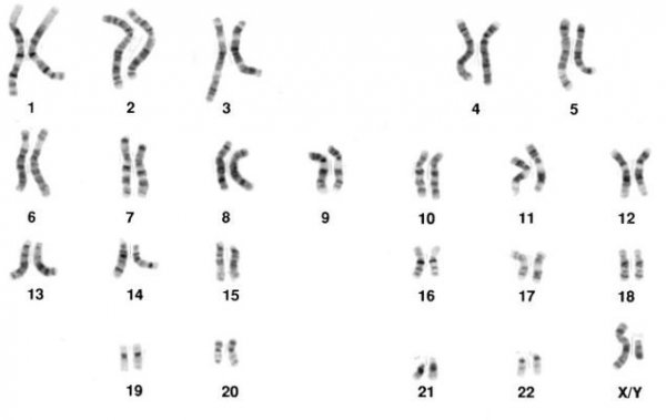 Science：没有Y染色体，同样能生娃(附：Y染色体进化<font color="red">史</font>)