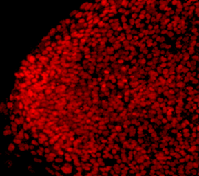 Sci Rep：编辑<font color="red">干细胞</font>疗法或可<font color="red">治疗</font>失明