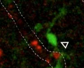 Science：少突胶质细胞如何通过血管进入<font color="red">大脑</font>？