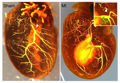 Cardiovasc Res：谱系示踪技术揭示心脏侧枝动脉的形成机制