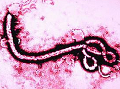 科学家研发出便携式埃博拉病毒检测“实验室”