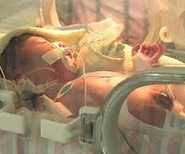 BMJ新闻：较高的氧饱和度治疗目标对早产儿更安全