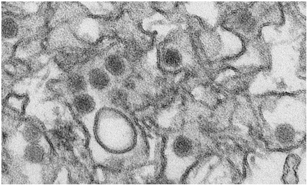 Emerg Infect Dis ：寨卡病毒可在男性精液中持续存在两个月