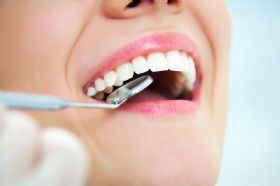Ther Clin Risk Manag：根面平整联合米诺环素局部应用可降低主要牙周致病菌的水平改善患者的症状