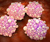 研究发现胰腺癌的四种新亚型