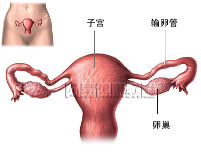 输卵管结扎术