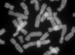 Science：染色体“绝缘区域”的改变或将激活<font color="red">致癌基因</font>的表达