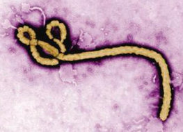 埃博拉病毒病疫情防控的思考