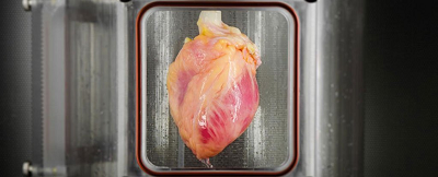 Circ Res：iPS技术制作出工程化心脏，心脏移植手术或将不必等待供体配型