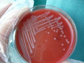 发现蛋白质乙酰化修饰<font color="red">调节</font>细菌毒力新机制