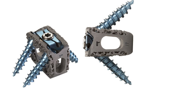 FDA批准Renovis公司3D打印颈椎间融合系统上市