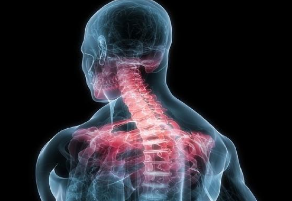 ISSAS 2016：影响脊髓型颈椎病患者手术方式的因素调查