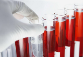 FDA批准第一款结直肠癌血液检测<font color="red">试剂</font>，检测Septin9甲基化