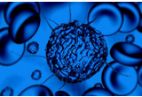 NEJM：Pembrolizuma（抗PD-1）治疗晚期默克尔细胞癌的研究