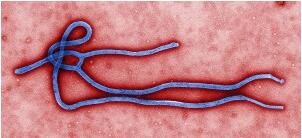NEJM：埃博拉疫苗rVSV-ZEBOV一期试验结果
