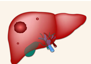 杨鹏远博士：<font color="red">肝癌</font>转移的免疫微环境调节机制