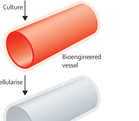 实验室培养的<font color="red">生物工程</font>血管或能取代人工血管
