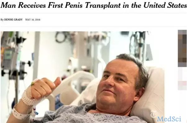 美国首例阴茎移植术咋整？