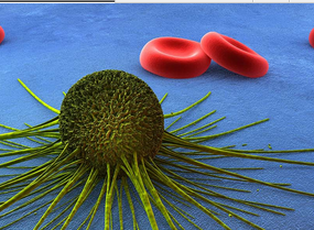PNAS：科学家改善自然杀伤细胞 准确狙杀癌细胞