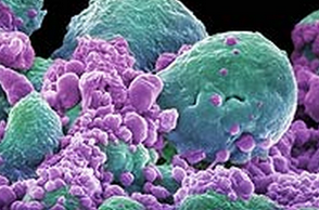 Oncotarget：新型无毒副作用疗法可治疗多种癌症