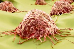 【Nature、Cell聚焦】癌症免疫疗法“最新综述”TOP8（附4项突破进展……）
