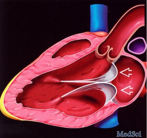 Heart：放疗时不可忽视的放疗相关心脏瓣膜病-<font color="red">综述</font>