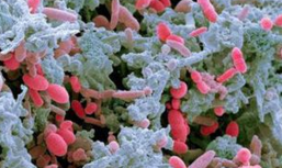 Science：肠道微生物调节肠炎新机制