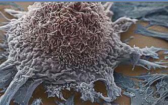 PNAS：高转移性肺癌细胞中发现Musashi-2高表达