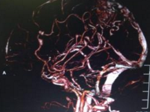 <font color="red">欧洲</font>发布首个心衰心血管成像的恰当性标准