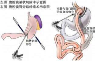 2016年上海交通大学医学院附属第九人民医院减重和代谢外科论坛