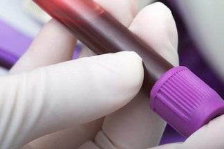 最新血液检测可诊断抗原<font color="red">未知</font>的疾病