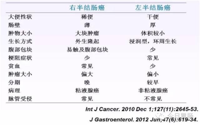 ASCO 2016：解读左右结直肠癌生存期差异很大