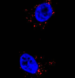 Cell Rep：利用CRISPR技术发现寨卡病毒和<font color="red">登革热病</font>毒弱点