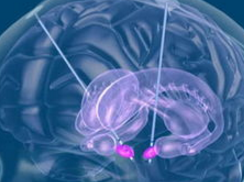 上海拟建全新戒毒模式：大脑中植入“脑起搏器”