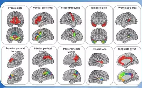中科院绘制246个精细亚区的全新人类脑图谱 为下一代诊疗技术奠定基础