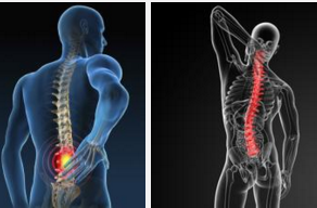 EULAR 2016：赛妥珠单抗可快速缓解中轴性脊柱关节炎患者的症状且效果可长达4年