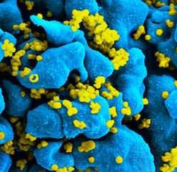 Virol：科学家发现逆转录病毒的结构并不相同